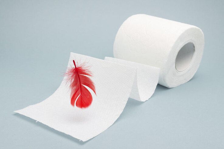 Blood on toilet paper is a sign of hemorrhoids